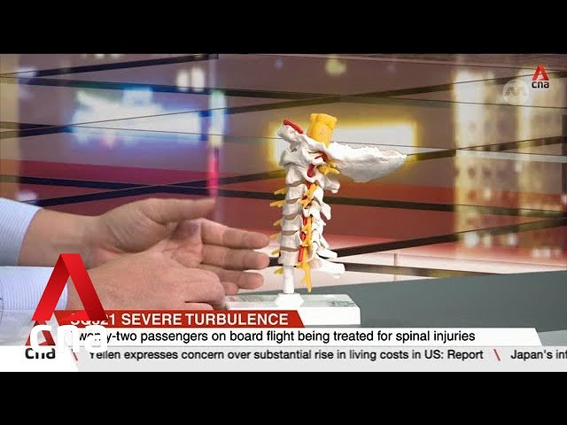 ⁣SQ321 turbulence: 22 passengers being treated for spinal cord injuries