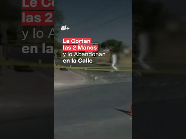 ⁣Le cortan las 2 manos y lo abandonan en la calle - N+ #Shorts