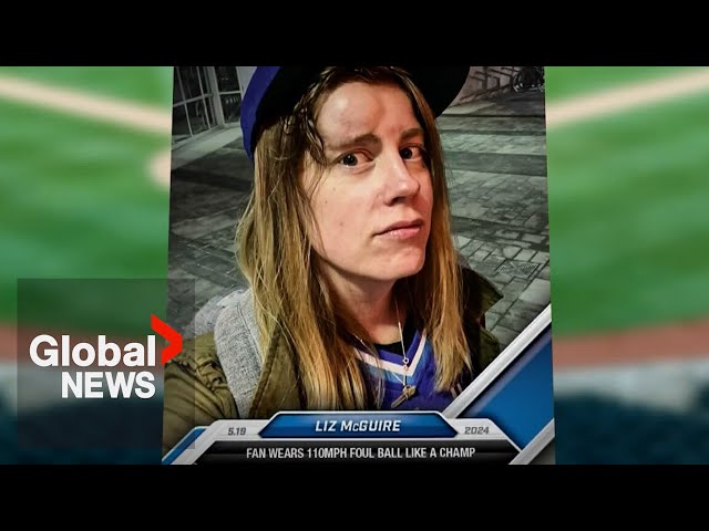 ⁣Toronto Blue Jays fan hit in face by baseball at game raising money for charity