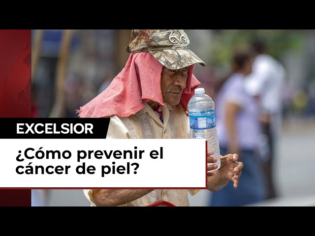 Factores de riesgo para el cáncer de piel