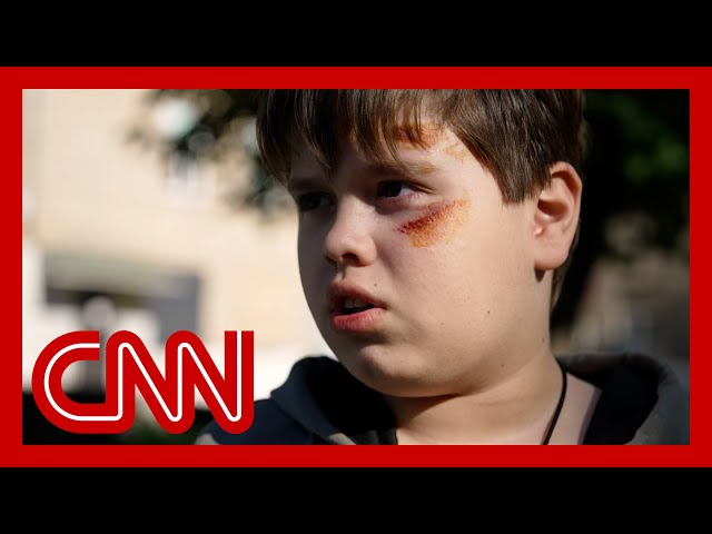 ⁣10-year-old boy describes losing his parents in Russian attack