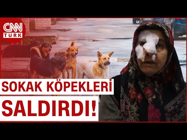 Sokak Köpeklerinin Saldırısına Uğradı, Canını Zor Kurtardı!