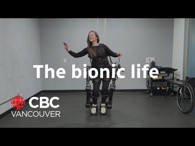 ⁣New technology helps woman rekindle her love of dancing