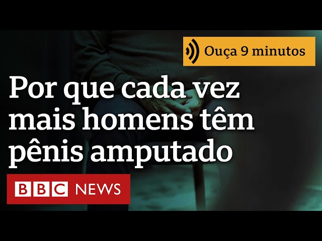 ⁣'Me sinto decapitado': por que cada vez mais homens têm o pênis amputado no Brasil?
