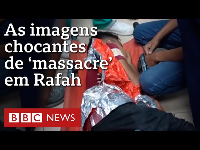 ⁣Ataque de Israel a campo de refugiados: por dentro de hospital com crianças feridas