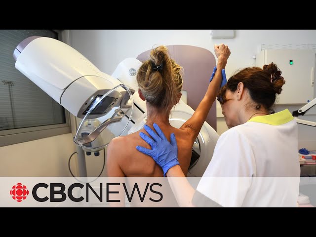 ⁣Breast screening at age 40 not routinely advised, Canadian task force says