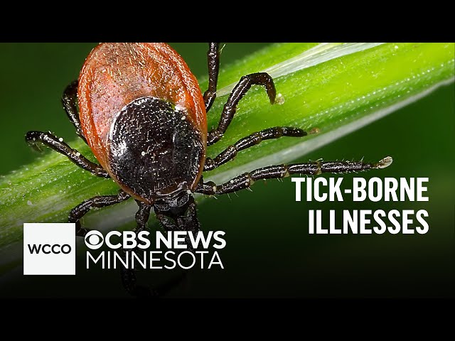 ⁣Ticks may be worse after the mild winter. What to know about tick-borne diseases | Talking Points
