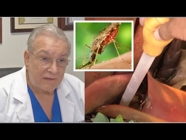 ⁣Aumentan los casos de Dengue en el Sur de la Florida
