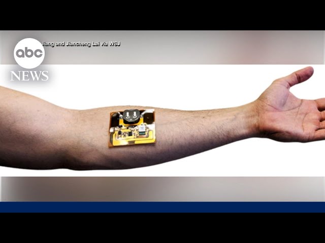 ⁣'Smart bandages' aim to improve healing and medical intervention