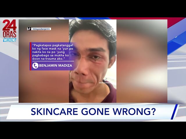 ⁣24 Oras Weekend: Skincare gone wrong?