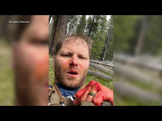 ⁣Veteran recovering from brain tumor on honeymoon attacked by grizzly bear