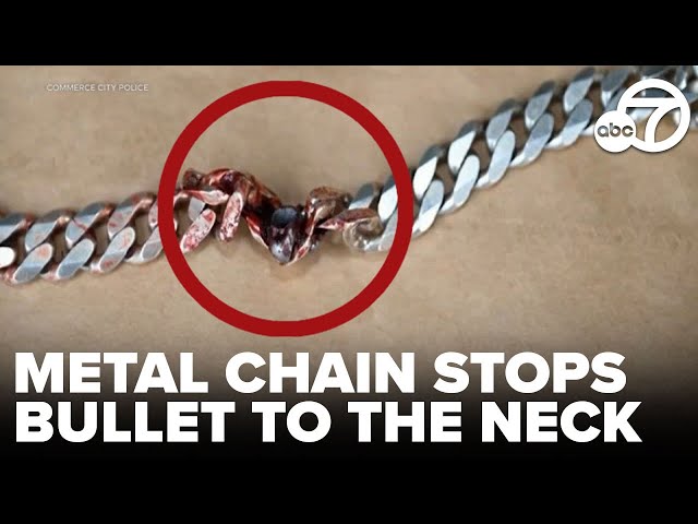 ⁣Metal chain blocks bullet to the neck, saves Colorado man's life