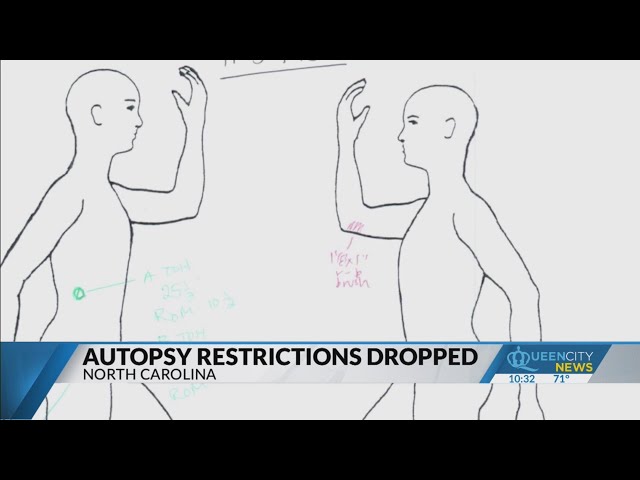 ⁣Senate bill proposal to restrict autopsy access dropped