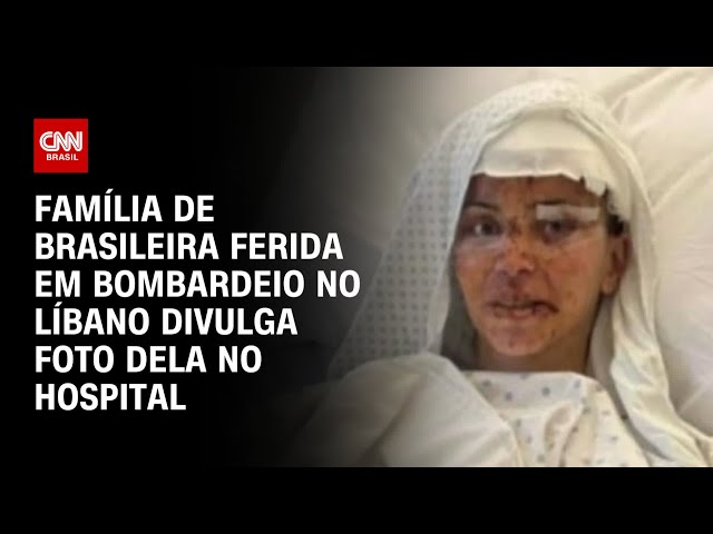 ⁣Família de brasileira ferida em bombardeio no Líbano divulga foto dela no hospital | CNN PRIME TIME