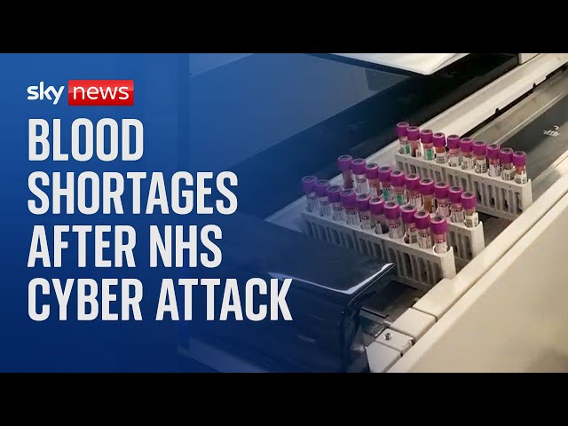 ⁣NHS issues urgent blood donation appeal after IT cyber attack