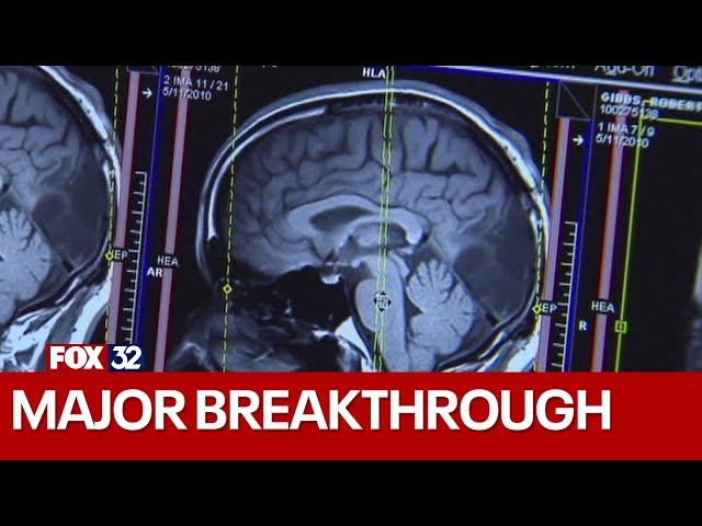⁣Northwestern Medicine achieves breakthrough in brain cancer treatment