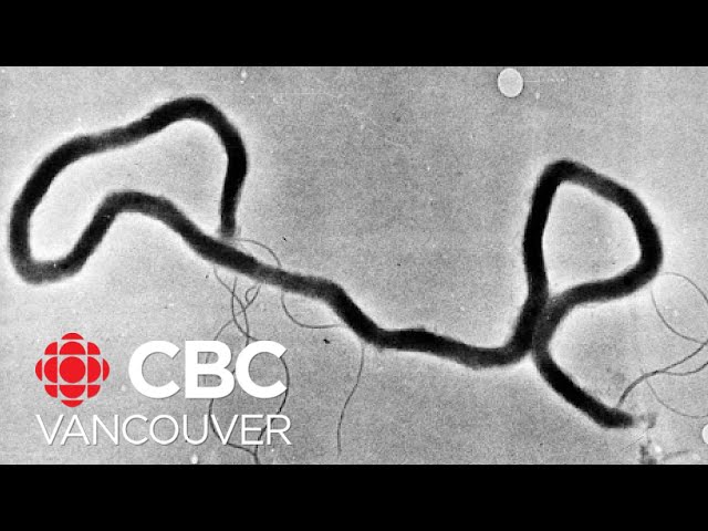 ⁣B.C. researchers are working to develop a syphilis vaccine