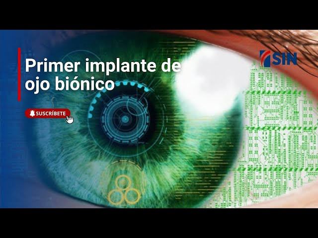 ⁣En la Red: Primer implante de ojo biónico un hito en la tecnología médica