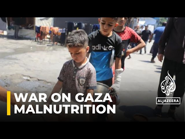 ⁣Children in Gaza suffering from disease due to malnutrition