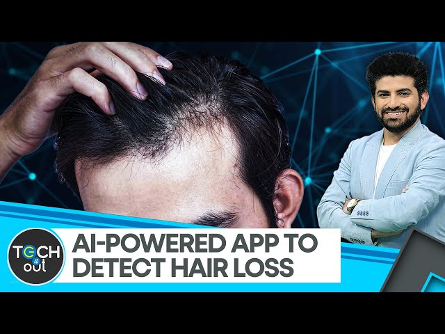 ⁣AI feature that checks if you’re balding | Tech It Out | World News | WION