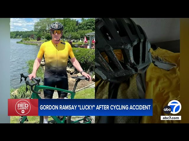 ⁣Gordon Ramsay says he's 'lucky' to be alive, shows off severe bruising after cycling 