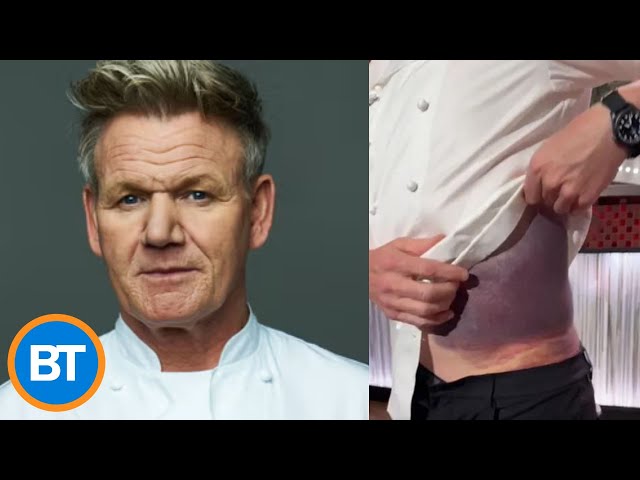 ⁣Chef Gordon Ramsay just experienced a horrible bike accident