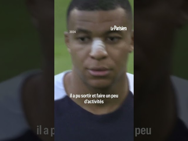 Nez de Mbappé : « On va faire en sorte qu’il soit disponible » face aux Pays-Bas, annonce Deschamps