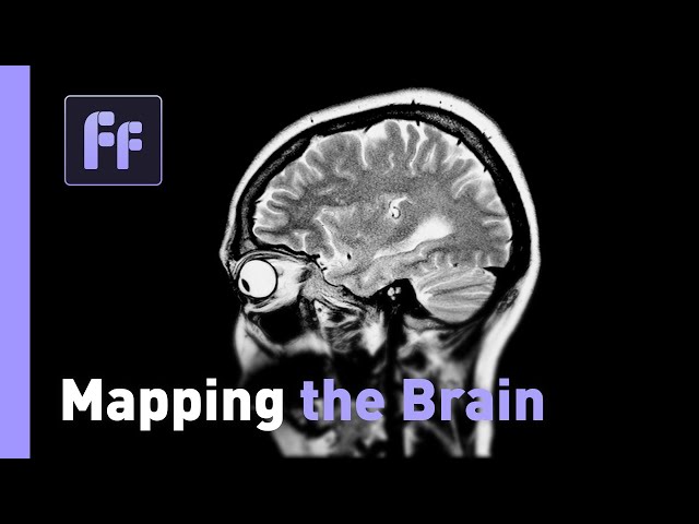 ⁣Mapping the Brain | Dr. Sergiu Pasca