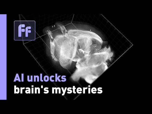 ⁣AI helps Johns Hopkins brain lab to unlock neuroscience mysteries