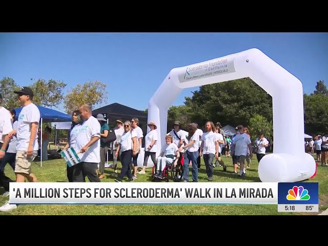 ⁣'A Million Steps for Scleroderma' walk in La Mirada