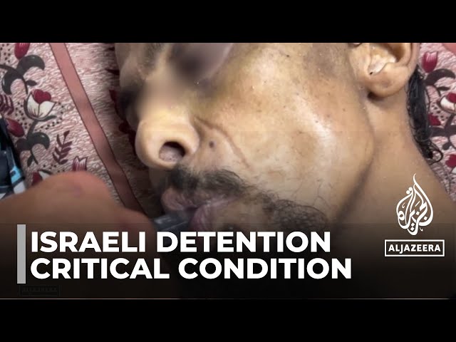 ⁣Palestinian Man Returns to Gaza with Life-Threatening Injuries After Alleged Detention by Israeli