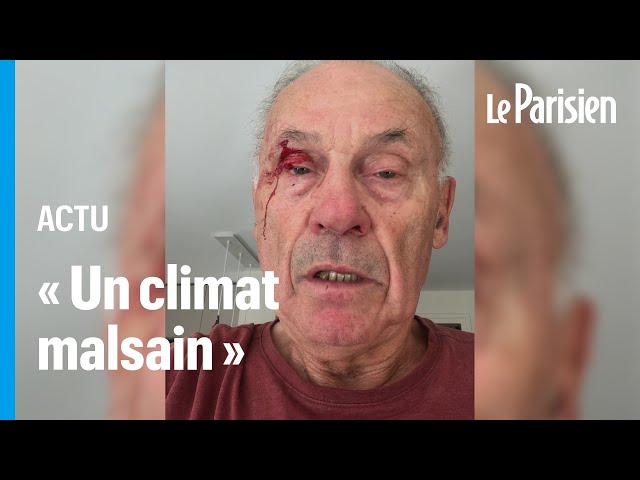 ⁣Législatives : un élu agressé en Isère alors qu’il collait des affiches pour Olivier Véran