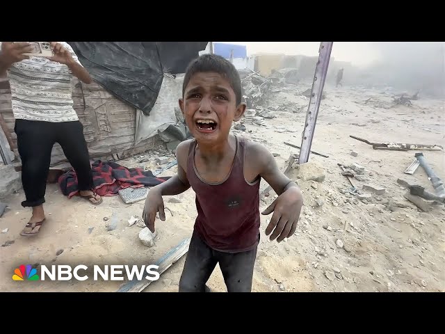 ⁣Children wounded in Gaza as Israel bombs area sheltering displaced families