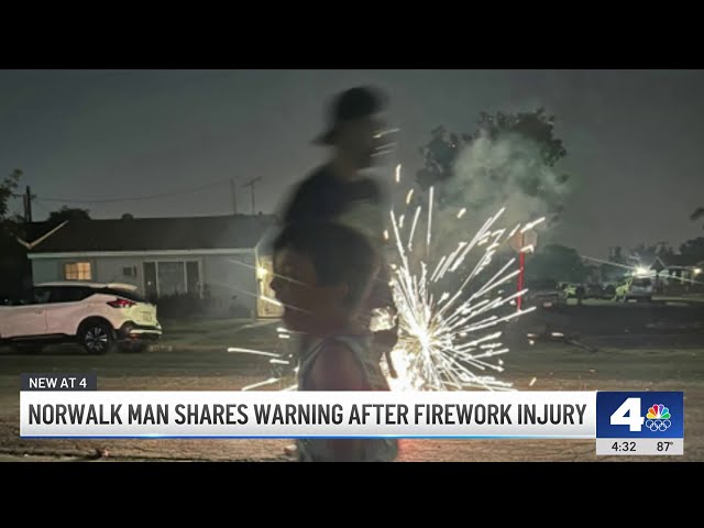 ⁣Norwalk man shares warning after frightening firework injury