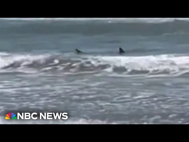 ⁣Texas shark attack survivor speaks out
