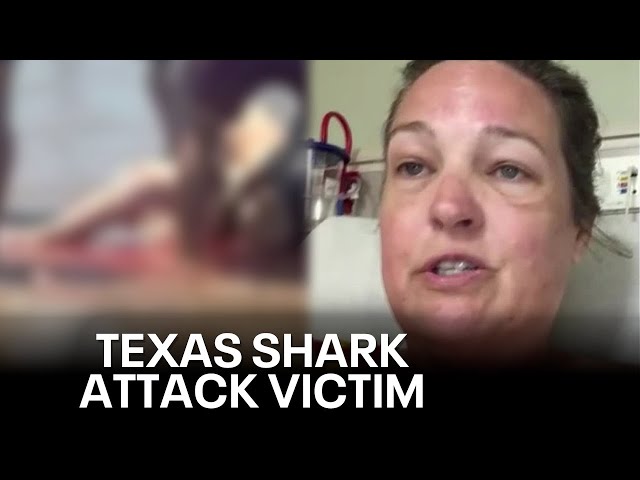 ⁣North Texas woman attacked by shark in South Padre: ‘I thought it was a big fish’
