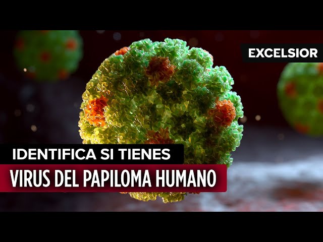 Identifica si tienes Virus del Papiloma Humano