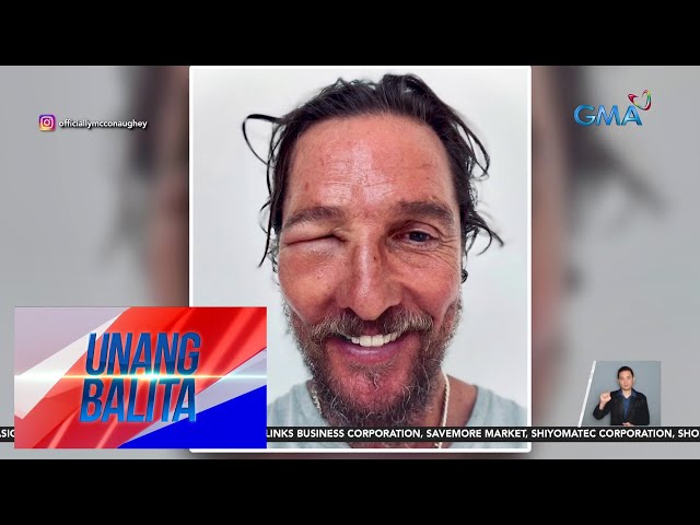 ⁣American actor Matthew Mcconaughey, namaga ang mukha dahil sa bee sting | Unang Balita