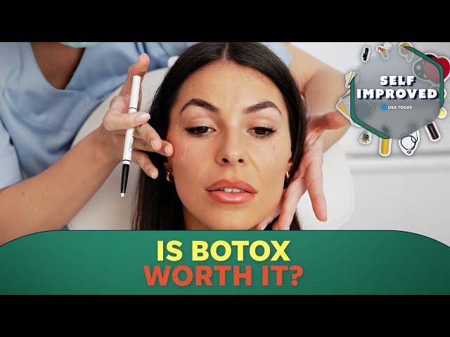 ⁣Dermatologist explains how Botox can improve your appearance | SELF IMPROVED