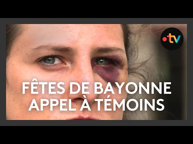 Agression d'une jeune femme pendant les Fêtes de Bayonne