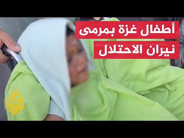 فلسطيني يغني لابنه المصاب بقصف إسرائيلي لتخفيف صدمته في غزة