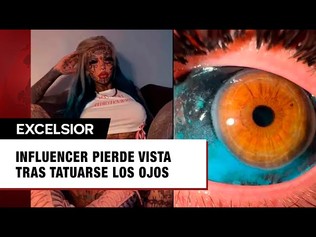 Influencer de tatuajes revela que se quedó ciega por semanas tras tatuarse los ojos