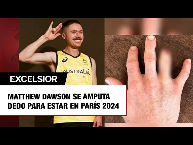 Matthew Dawson se amputa dedo para estar en París 2024; así lo vivió