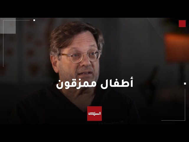 ⁣جراح عظام يهودي أميركي:  لم أشاهد في حياتي أطفالا ممزقين ومحروقين كما في غزة