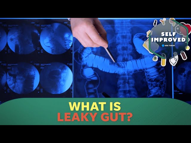 ⁣Expert explains how leaky gut can increase the risk of cancer | SELF IMPROVED