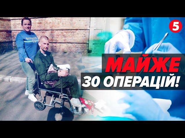 Роблять ДИВА! Українські МЕДИКИ рятують КІНЦІВКИ пораненим українцям