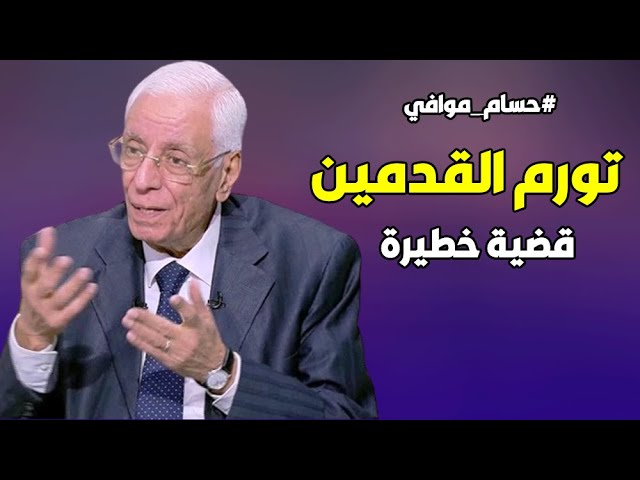 ⁣أسباب تورم القدمين وطرق علاجها .. د. حسام موافي: قضية طبية خطيرة جدا