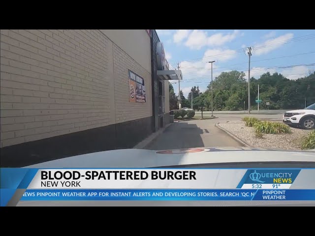 ⁣Q&A: Mother finds blood in Burger King meal