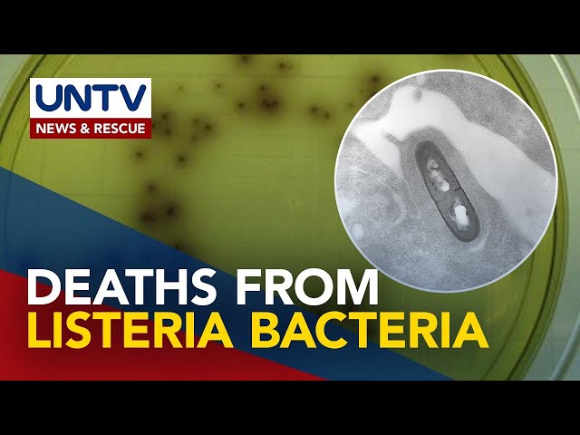 ⁣18 kaso ng sakit na listeria, naitala sa Canada; Dalawang pasyente, nasawi