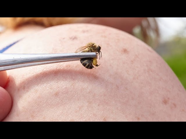 ¿Las picaduras de abeja pueden aliviar los fuertes dolores?